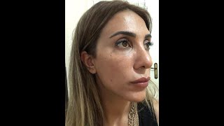 Melexder ile 3 Hafta (final)