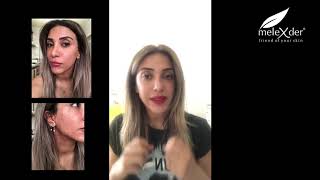 Melexder ile 3 Hafta Tanıtım